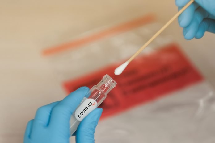 Tamponi e test sierologici, il camper arriva a Darfo, Vezza e Ceto