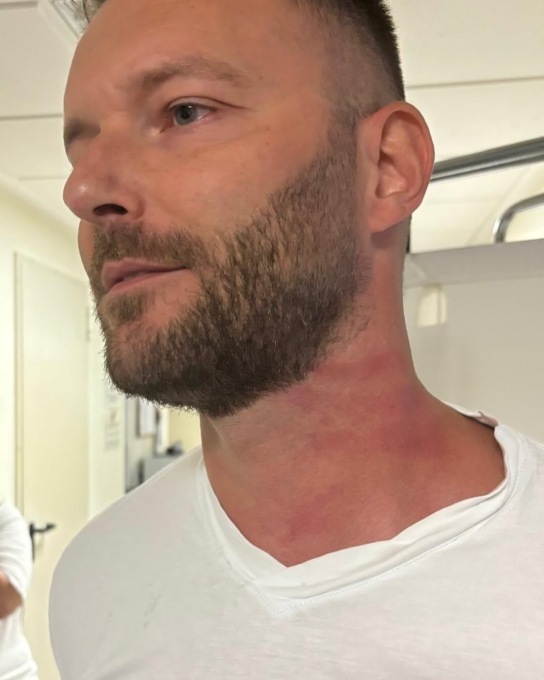 Medico aggredito all’ospedale di Chiari